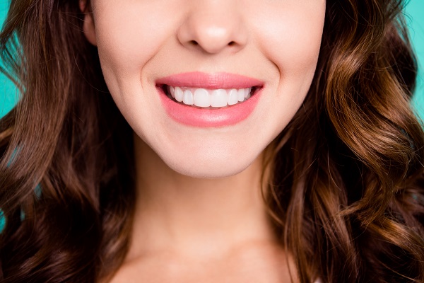 Three Benefits Of Dental Bonding